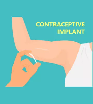 Birth Control Implant Effectiveness Benefits And Side Effects
