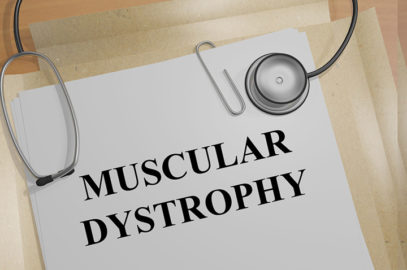 Congenital Muscular Dystrophy: Causes, Symptoms, And Treatment