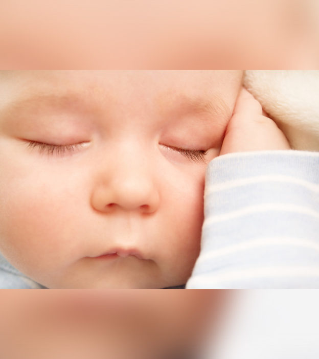 Congenital Ptosis In Babies: Causes, Symptoms And Treatment