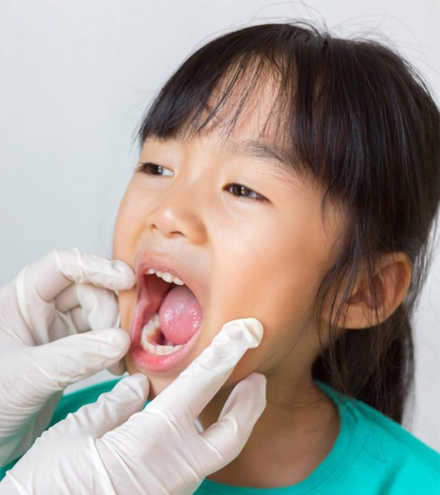 Causes Of Epiglottitis In Children, Symptoms And Treatment
