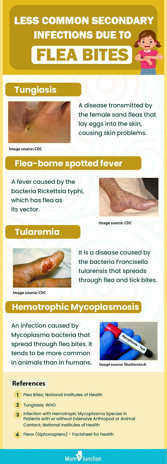 cat flea bites on humans treatment