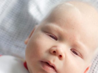 Congenital Nystagmus In Babies: Types, Symptoms And Treatment