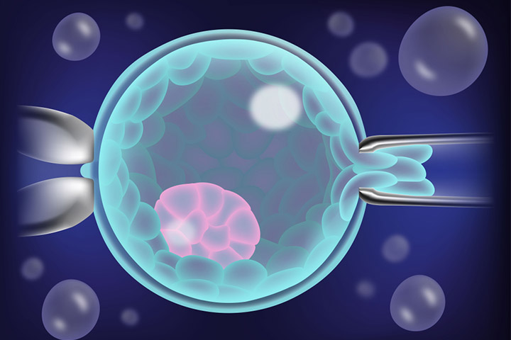 This method is carried out in combination with in-vitro fertilization