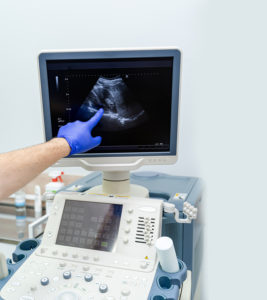 What You'll See At 5-Week Ultrasound & How To Prepare For It