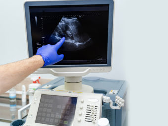What You'll See At 5-Week Ultrasound & How To Prepare For It