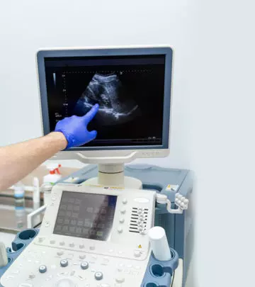5-Week Ultrasound