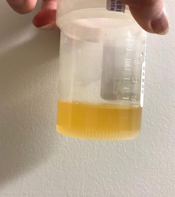 Cloudy Urine Only In The Morning During Pregnancy