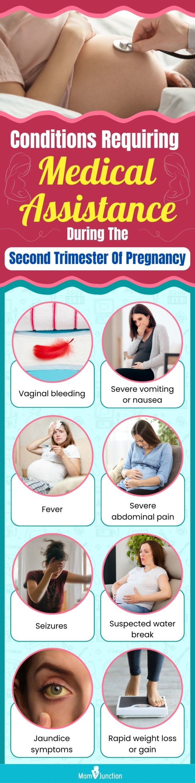 conditions requiring medical assistance during the second trimester of pregnancy (infographic)