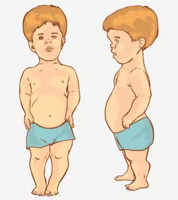 Dwarfism In Children: Types, Causes, Symptoms And Treatment