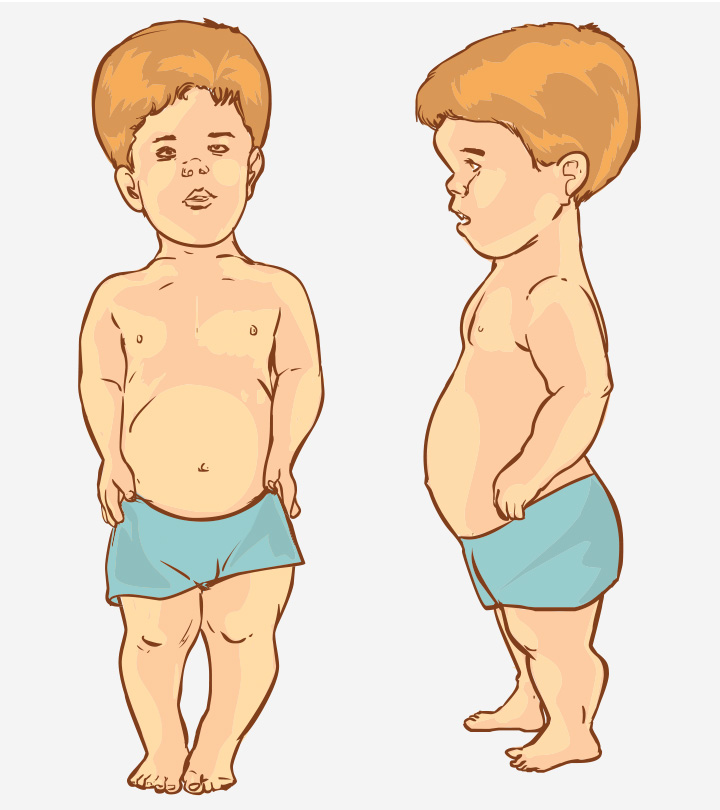 儿童侏儒症:类型、原因、症状和治疗