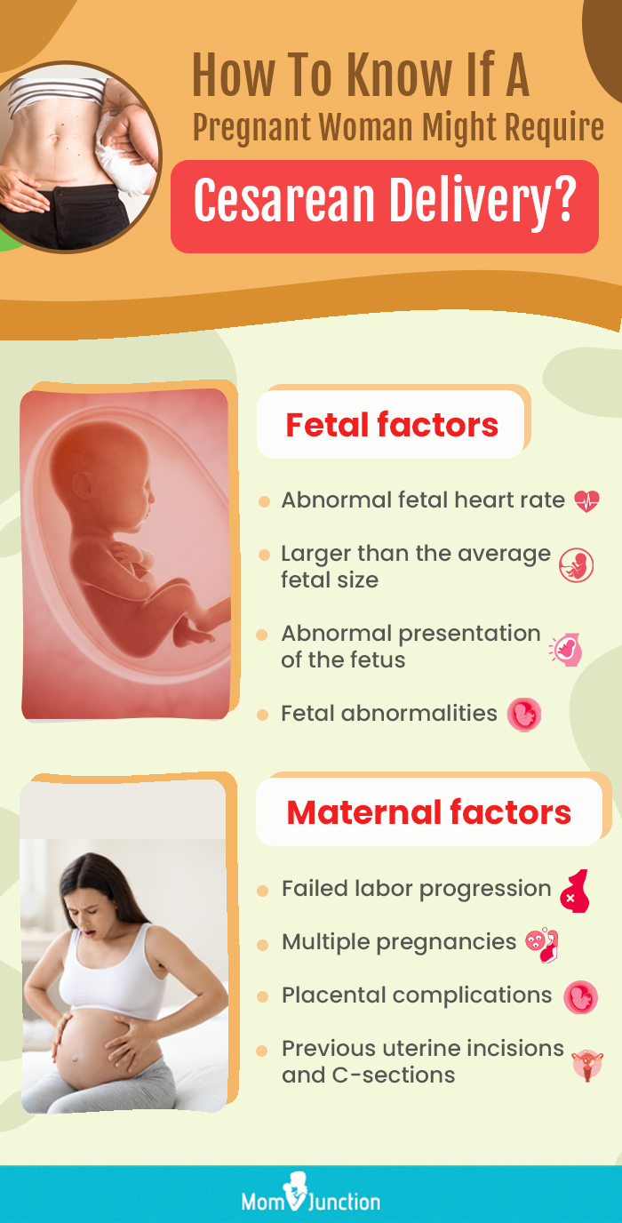 how to know if a pregnant woman might require cesarean delivery (infographic)