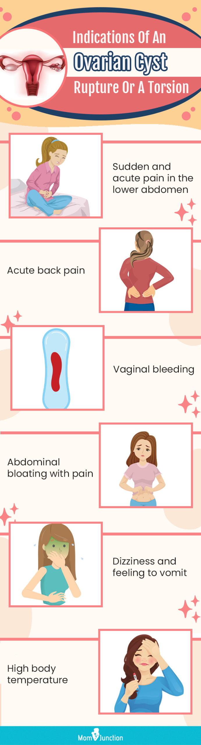 indications of an ovarian cyst rupture or a torsion (infographic)