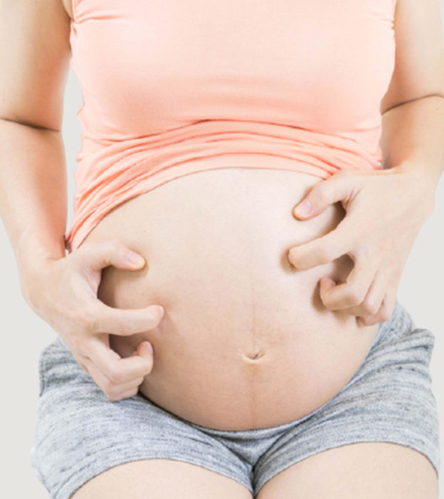 Itching In Pregnancy: Is It Normal, Causes And Treatments