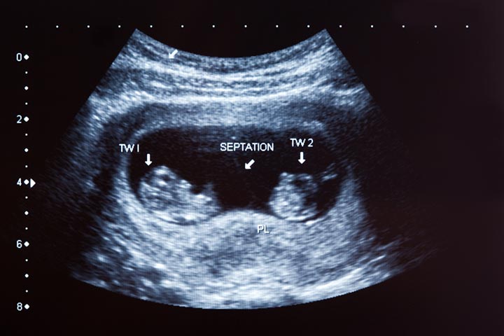 Ultrasound can detect twins between six and eight weeks.