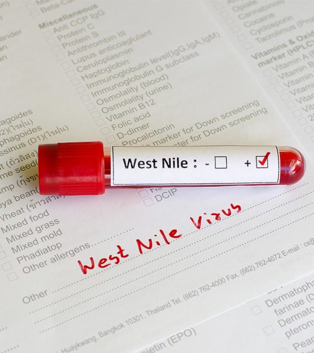 Signs Of West Nile Virus In Children, Treatment & Prevention