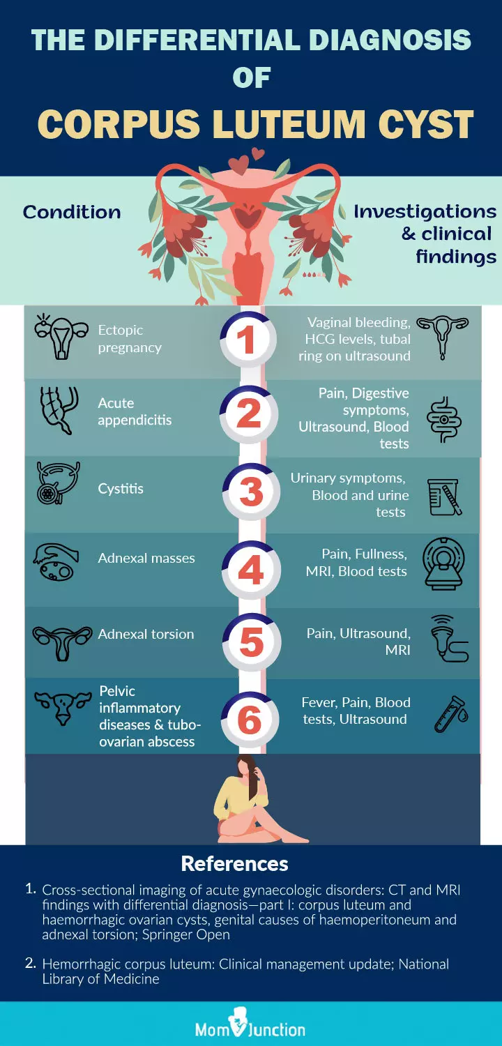 corpus leuteum (infographic)