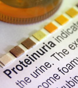 Proteinuria In Children: Causes, Symptoms, Risk Factors And Treatment