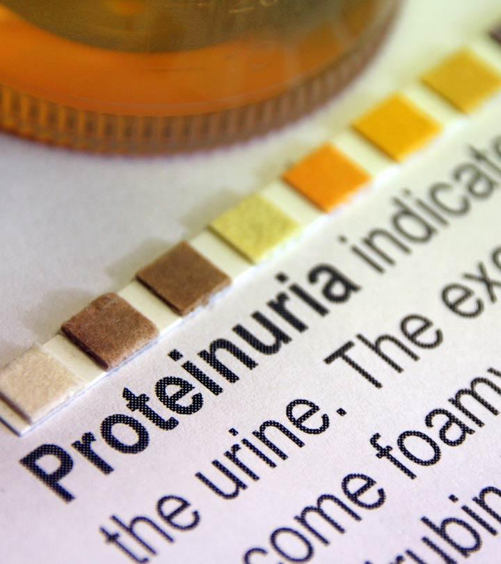 Proteinuria In Children Causes, Symptoms, Risks & Treatment