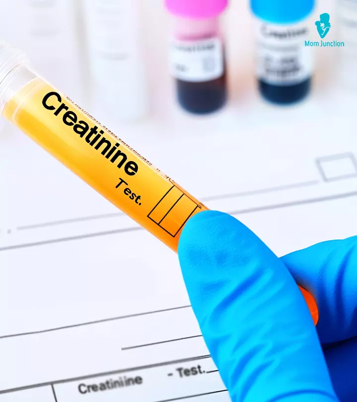 Creatinine test