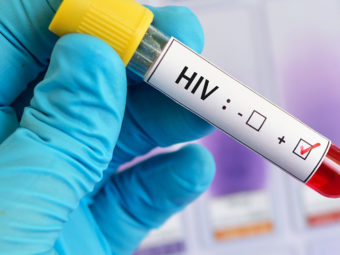 HIV And Pregnancy: Causes, Effects, Diagnosis And Treatment