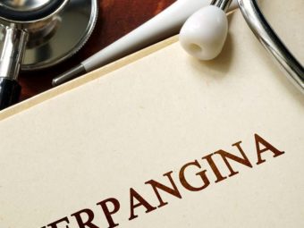 Herpangina In Children: Causes, Symptoms, Treatment, And Prevention
