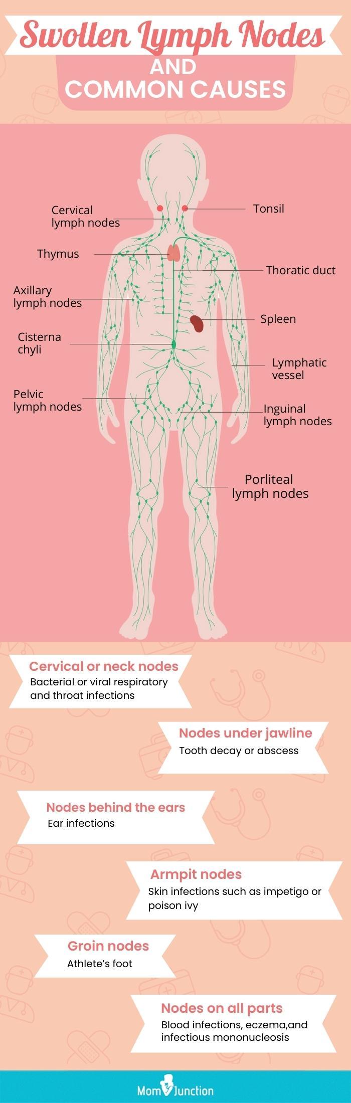 difference between swollen and shotty lymph nodes