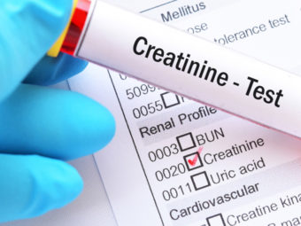 Low-Creatinine-In-Children-Causes,-Symptoms,-Diagnosis,-And-Treatment
