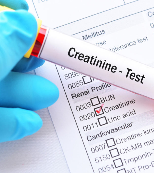 Low Creatinine In Children: Causes, Symptoms, Diagnosis, And Treatment