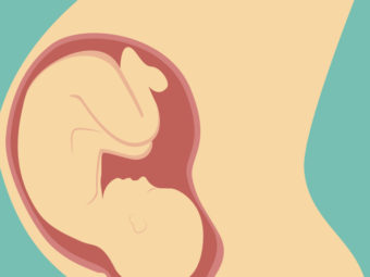 क्या सिजेरियन डिलीवरी के बाद नॉर्मल डिलीवरी संभव है? | Normal Delivery After Cesarean Section In Hindi