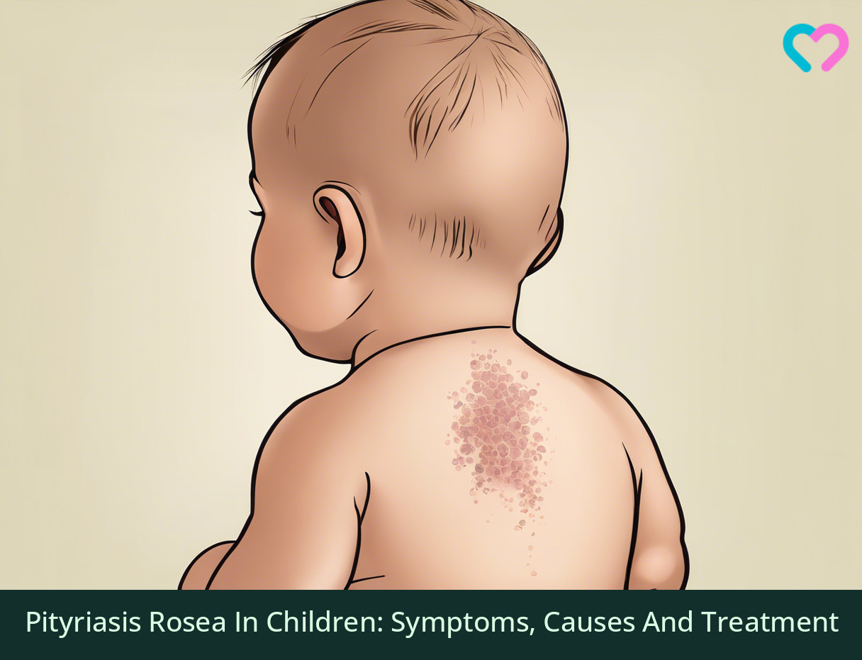 Pityriasis Rosea In Children: Symptoms, Causes And Treatment_illustration