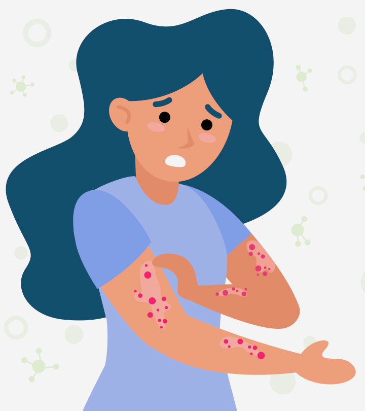 Roseola (Sixth Disease) In Pregnancy: Safety And How To Treat It