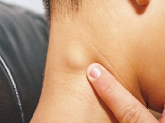 Swollen Lymph Nodes In Children: Causes And When To Worry