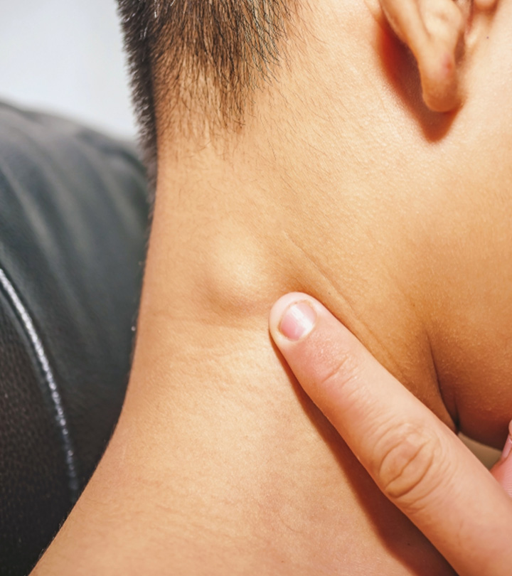 Swollen Lymph Nodes In Children: Causes And When To Worry
