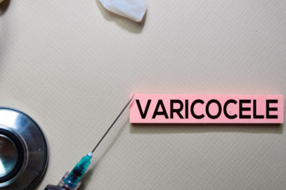 Varicocele In Children: Symptoms, Diagnosis, And Treatment