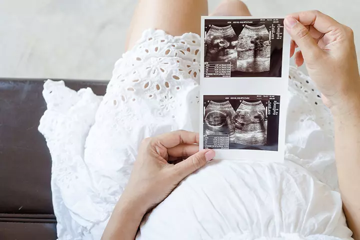 Why Do You Have A Scan In The 12th Week Of Your Pregnancy