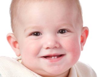 शिशु के जन्म के समय से दांत : कारण, जोखिम व घरेलू देखभाल  | Natal Teeth In Hindi