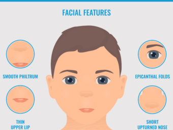 Child With Fetal Alcohol Syndrome (FAS): Symptoms & Treatment