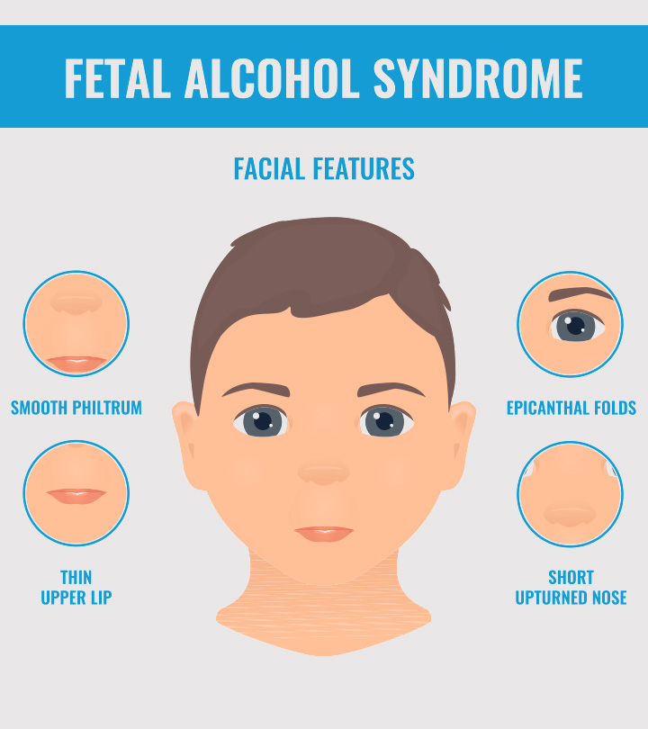 孩子胎儿酒精综合症(FAS):症状& Treatment