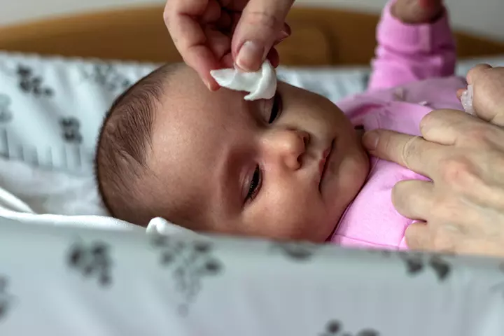Cleaning Your Baby's Eyes