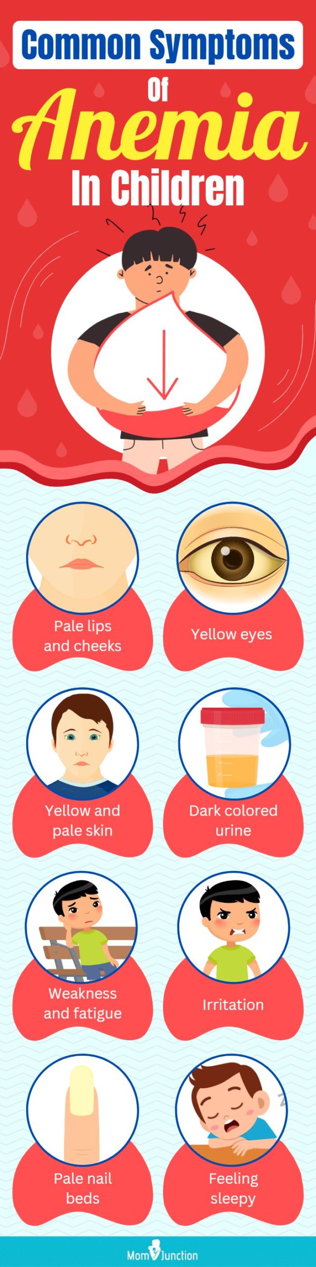 common symptoms of anemia in children (infographic)
