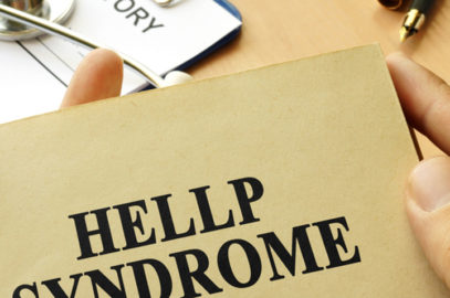 HELLP Syndrome: Causes, Risk Factors, Symptoms, And Treatment