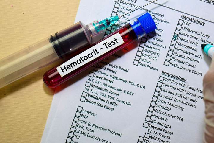 Hemoglobin and hematocrit test to detect anemia in children