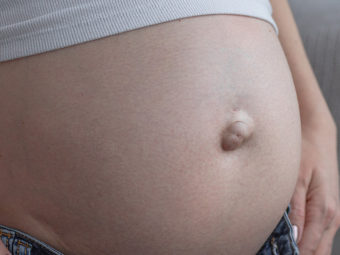 What Causes Umbilical Hernia In Pregnancy & How To Treat It?