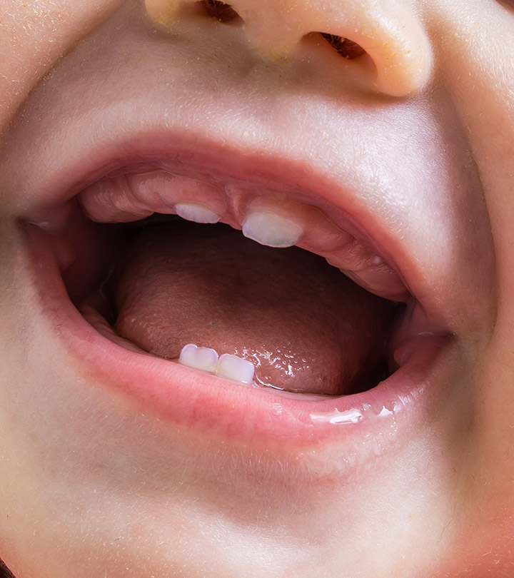 When Do Babies Get Molars Symptoms Pain Remedies And Care