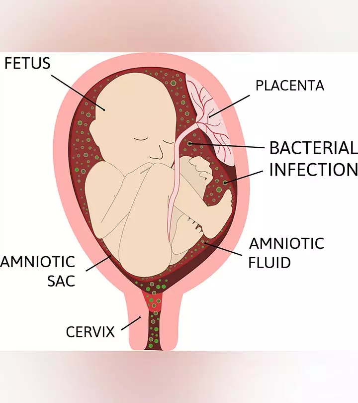 Is it caused by bacteria or something else? Knowing it could help you take the right call. 