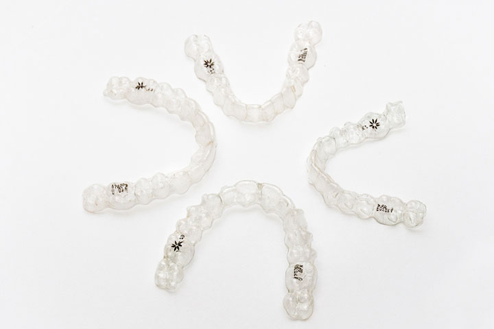 At-home clear aligners
