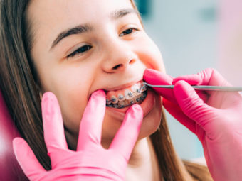 What Age Do Kids Get Braces? Types, Food And Dental Care