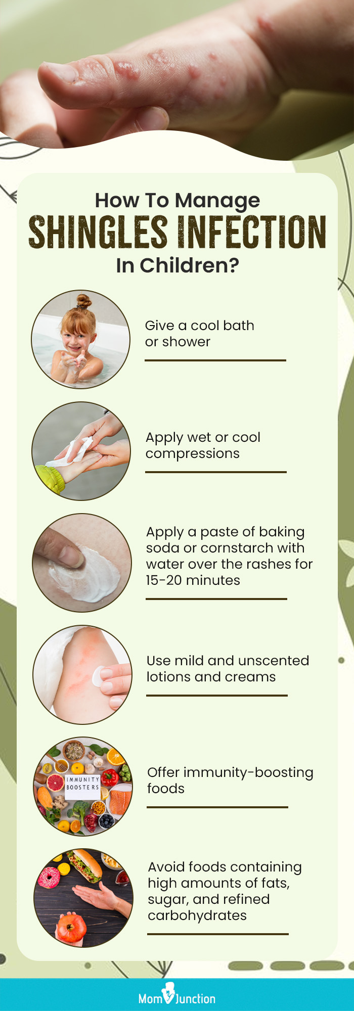 how to manage shingles infection in children (infographic)