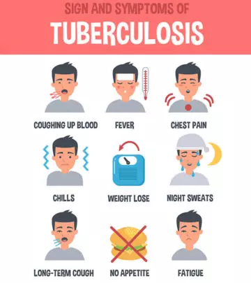 Tuberculosis (TB) In Children Types, Causes, Symptoms, And Treatment
