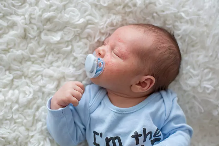 Hand, Foot And Mouth Disease